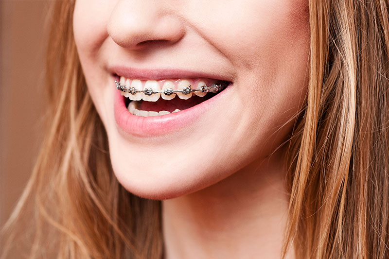 Orthodontics in Cincinnati